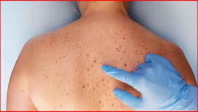 Skin cancer: क्यों सूरज की किरणें बन सकती हैं जानलेवा खतरा, पहचाने शुरुआती लक्षण जो बचा सकते हैं आपकी जान